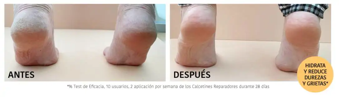 7  Resultados Melocotón
